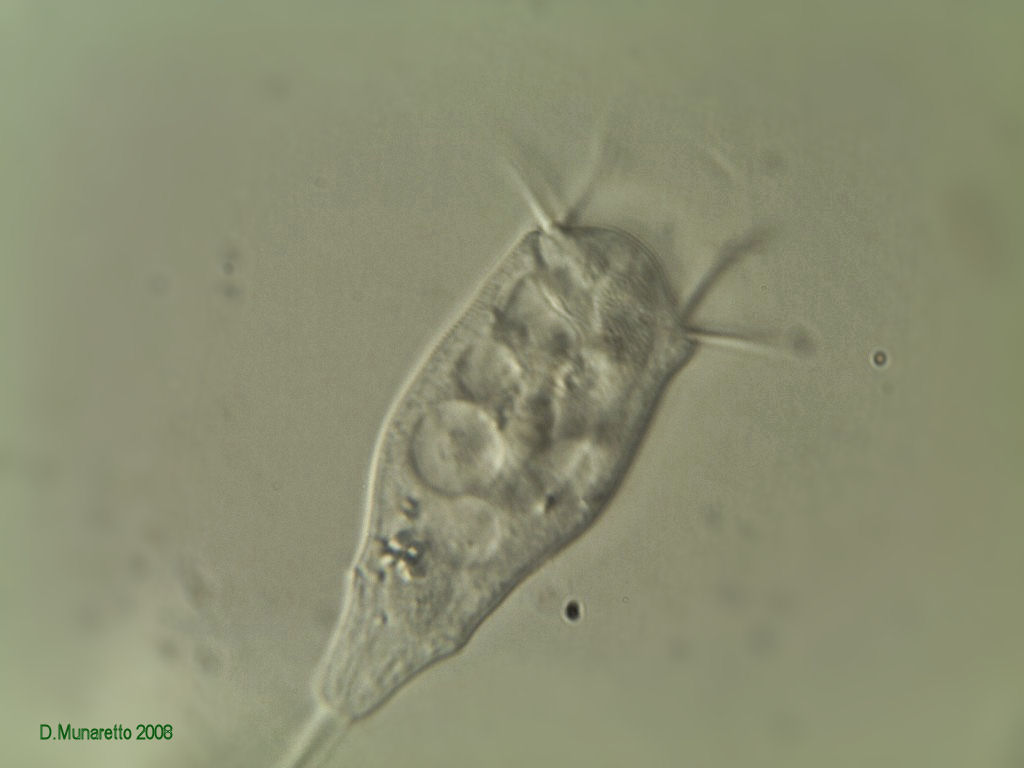 Vorticella in varie fasi di apertura